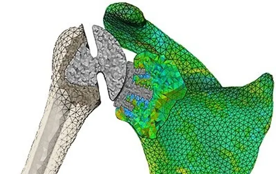 Engineering Simulation for Medical