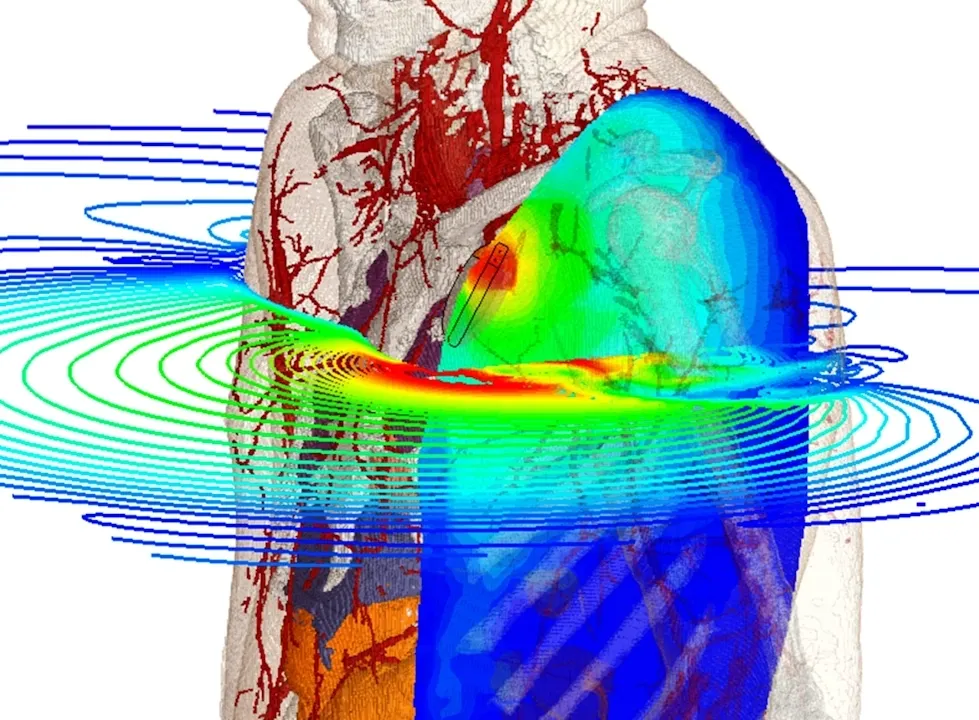 Emag for medical devices