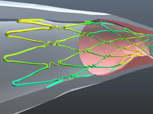 FEA for medical devices